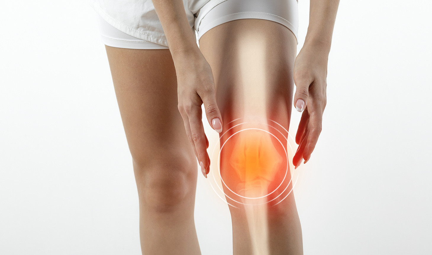 Discover the 3 Early Knee Arthritis Symptoms