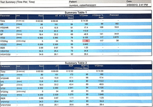 Um novo modelo para coletivo de discos 